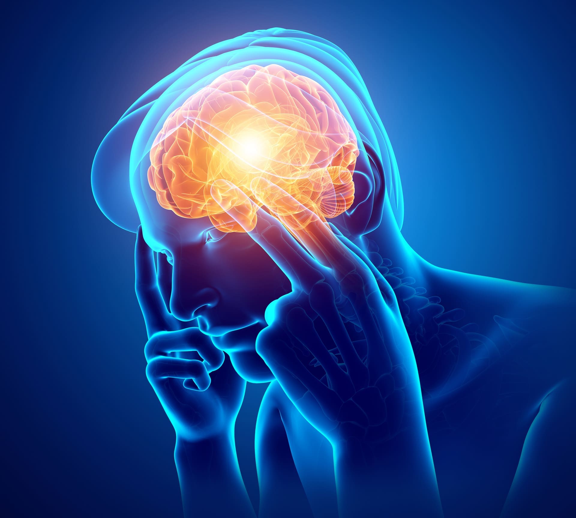 Savoir distinguer les types de maux de têtes - MCT Douleur chronique