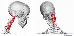 Schéma du squelette humain avec la zone du cou ciblée